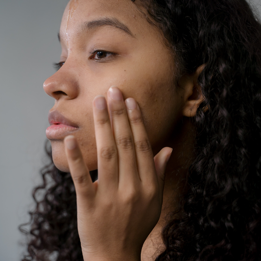 Acne op je hoofdhuid en rug door haarproducten